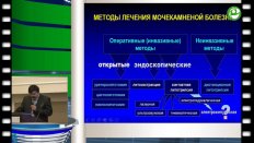 Жунусов С.А. - Эндоскопическая контактная наносекундная электроимпульсная литотрипсия в лечении мочекаменной болезни