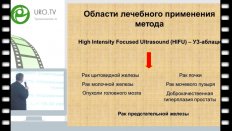 Уренков С.Б. - HIFU-терапия в лечении рака простаты