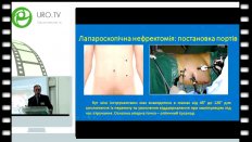 Григоренко В.М. - Лапароскопическая хирургия опухолей почки
