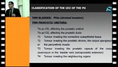 Rodrguez Faba - Prostate and upper urinary tract involvment by urothelial carcinoma