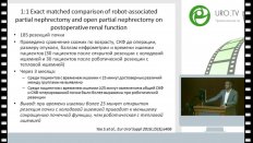 Велиев Е.И. - Роботические операции в урологии