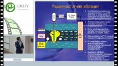 Андабеков Т.Т. - Возможности радиочастотной аблации в онкоурологии