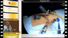Valla J-S - Видеохирургические реконструктивно-пластические операции в детской урологии(Детская больница Lenval, Ницца, Франция) 