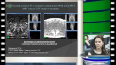 Ахвердиева Г.И.  - "Мультипараметрическая МРТ в диагностике рецидивов рака предстательной железы"