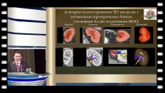Шпоть Е.В. - "Трехмерное моделирование анатомических и патологических структур при заболеваниях почки и программное обеспечение для 3D-визуализации в урологии"