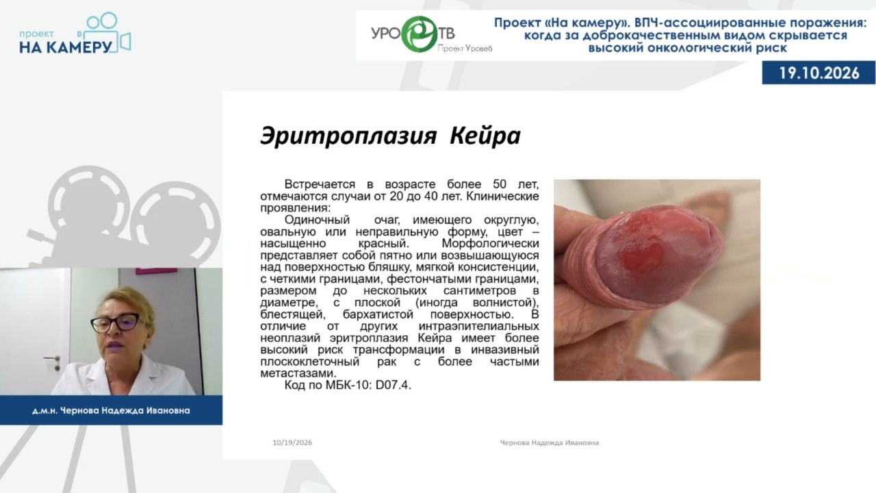 ВПЧ-ассоциированные поражения: когда за доброкачественным видом скрывается высокий онкологический риск
