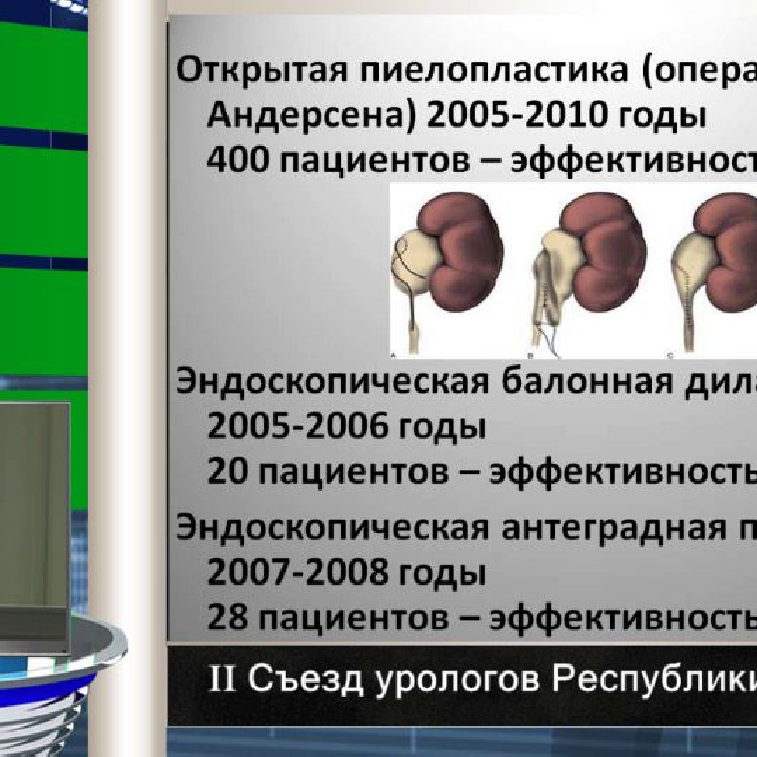Операция хайнса андерсена кучера. Операция хайнса андерсена кучера. Пластика лоханочно-мочеточникового сегмента. Операция по хайнсу-андерсену пиелопластика. Операция по хайнсу-андерсену пиелопластика.