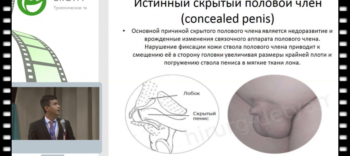 Период полового созревания у мальчиков и девочек | блог клиники Наше Время