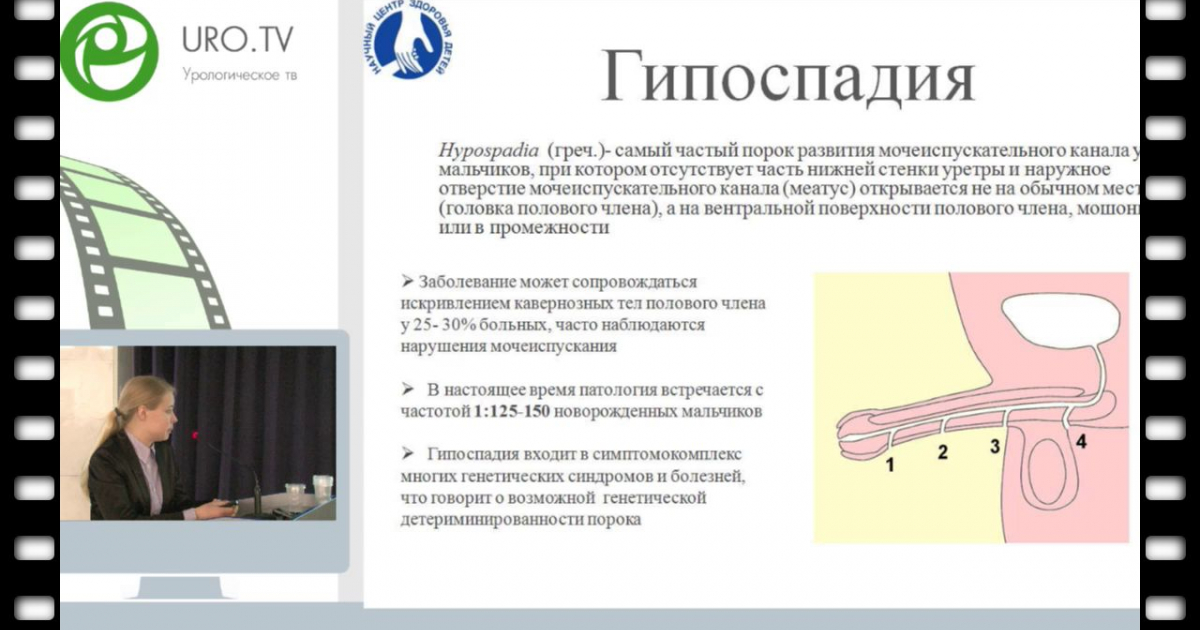 Мужской половой член - читайте бесплатно в онлайн энциклопедии «balagan-kzn.ru»