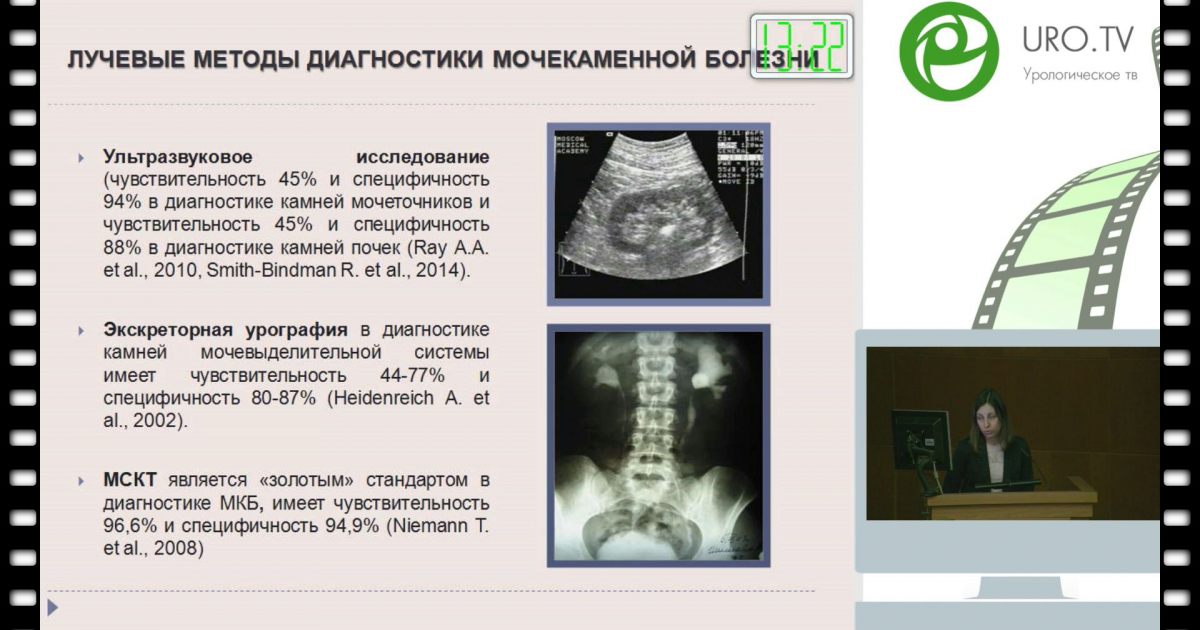 План обследования при мочекаменной болезни