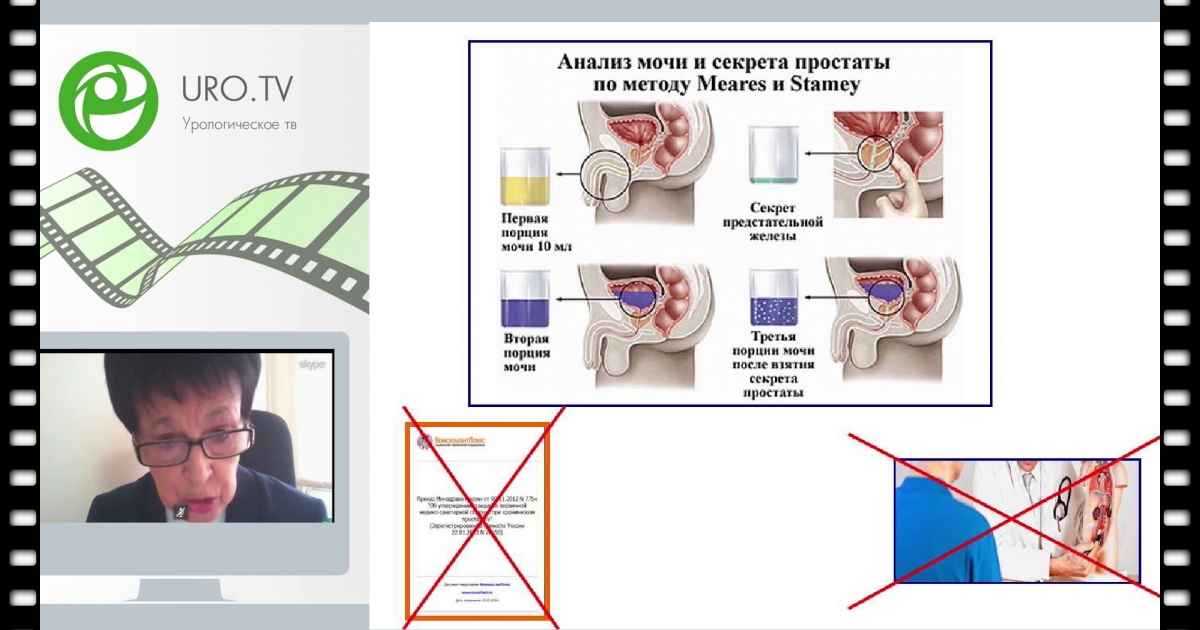 Секрет простаты анализ. Проба Stamey Meares. Четырехстаканная проба Meares и Stamey. Специфические урологические исследования. Анализ Meares и Stamey..