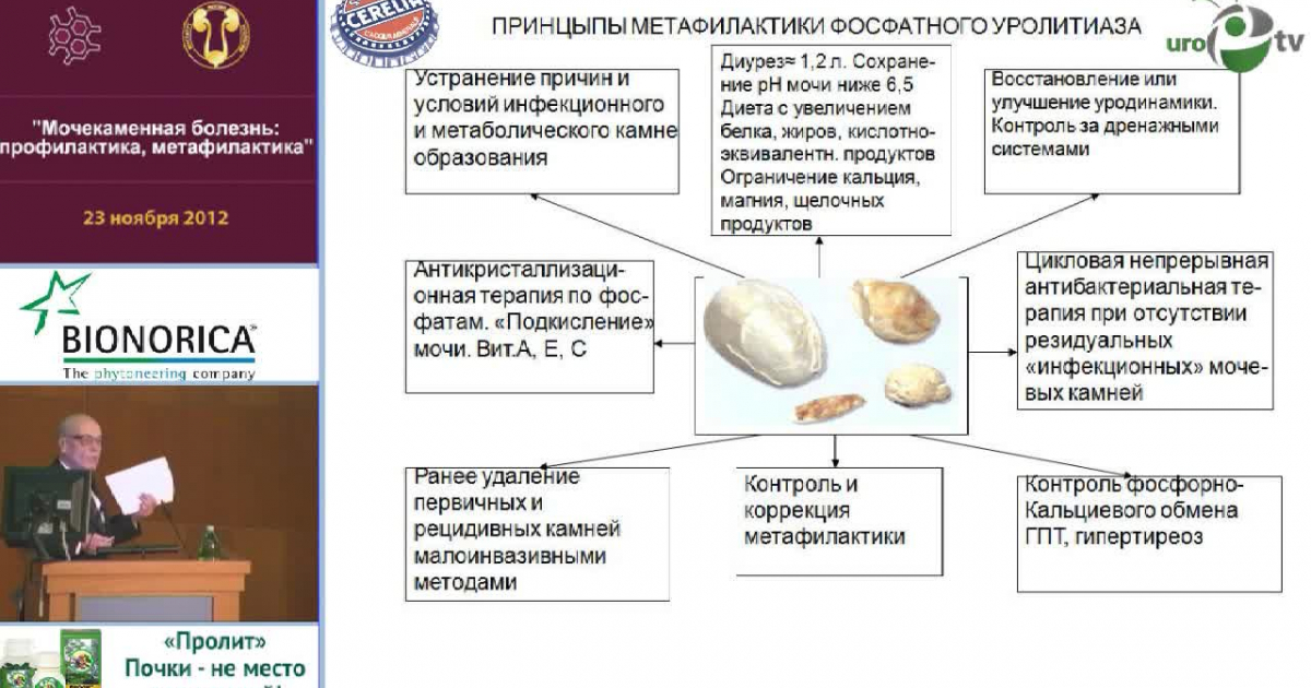 Низшее восстановление. Памятка пациенту с мочекаменной болезнью. Профилактика мочекаменной болезни. Профилактика мочекаменной болезни памятка. Метафилактика уролитиаза.