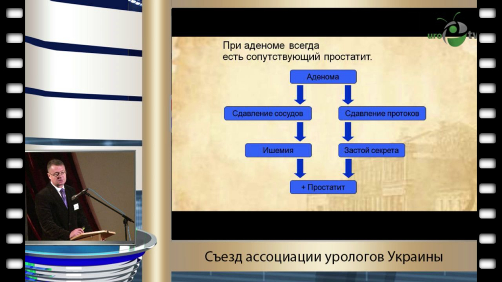 Аденома предстательной железы - презентация онлайн