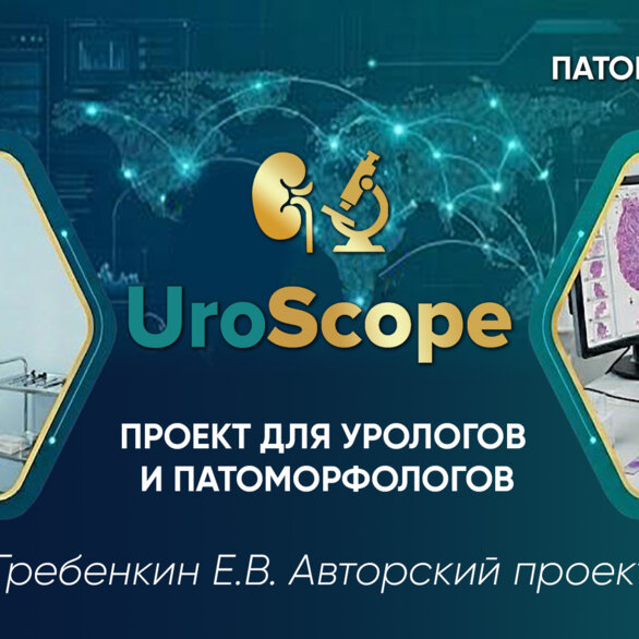 UroScope. Проект для урологов и патоморфологов. Выпуск №3. « Биопсия простаты - на что обращать внимание? Разговор о шкале Глисона»