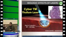R. Stubinski (Italy) - Cyber TM thulium laser in state of art urology