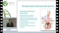Кызласов П.С. - Ведение пациентов с искусственным сфинктером уретры