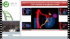 Аляев Ю.Г. - Современные тенденции диагностики и лечения рака почки