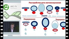 Сарычев С.А. - Роль периодической катетеризации мочевого пузыря у детей с хронической задержкой и недержанием мочи