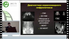 Амосов Н.А. - Особенности комбинированного рентгенэндоскопического лечения коралловидного нефролитиаза