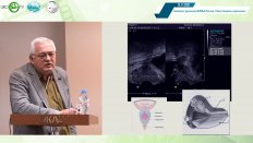Рыхтик П.И - Эластометрия при проведении мультипараметрического ультразвукового исследования предстательной железы