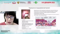 Масленникова А.В. -  Современные подходы к диагностике и коррекции мукозита слизистой оболочки полости рта и глотки