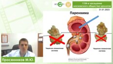 Просянников М.Ю. - Патогенетически обоснованная метафилактика мочекаменной болезни
