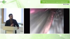 Мамаев И.Э., Котов С.В. - Стриктура мочеточника и сниженная функция. Когда овчинка стоит выделки?