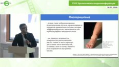 Сулейманов М.М. - Перкутанная резекция миоперицитомы полостной системы почки