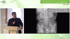 Трушкин Р.Н., Медведев П.Е., Исаев Т.К., Иванов К.В., Щеглов Н.Е.- Лапароскопический уретероцистоанастомоз (по Боари)