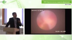 Яковлев В.Д. - Хирургическое лечение фиброэпителиальных полипов верхних мочевых путей больших размеров. Новое в возможностях