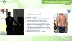Раджабов Р.М. - Уролитиаз у пациента с кифосколиозом: нестандартная ситуация - стандартный результат