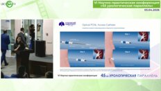 Хабиб Д.С. - Инновационные подходы к лечению МКБ