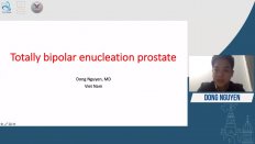 Dong Nguyen - Totally enbloc bipolar enucleation the prostate