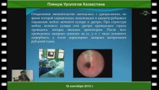Табынбаев Н.Б. "Применение малоинвазивных технологий в оперативном лечении рубцовых сужений нижних мочевыводящих путей"
