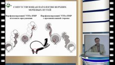 В.Д. Кулаев - Патогенез сопутствующей патологии верхних мочевых путей у детей с эктопическим уретероцеле