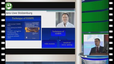 Новиков А.Б. - Лапароскопическая радикальная простатэктомия, варианты доступа