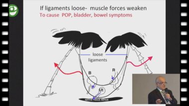 Peter P. Petros - Основные положения Интегральной теории функционирования тазового дна – компас для практикующего хирурга