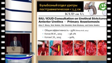 Котов С.В. - Хирургия первичных стриктур