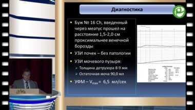 Митусов В.В. - Уретропластика по ASOPA протяженной пенильно - бульбозной стриктуры уретры доступом Аустони