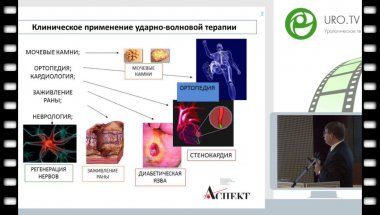 Винаров А.З. - ДУВТ – новый эффективный метод лечения больных с эд или фикция?