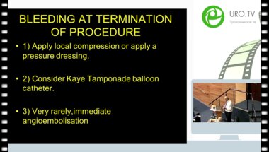 Arthur Smith - Catastrophies comp AUA2014 SUBMITTED