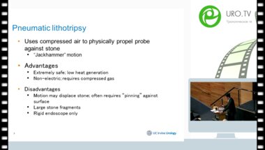 Zhamshid Okhunov - lithotripsy types presentation