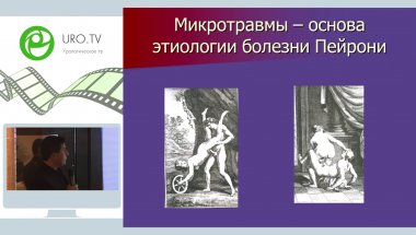 Гвасалия Б.Р. - Хирургическое лечение Пейрони