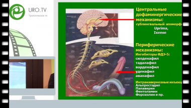 Овчинников Р.И. - Дистанционная ударно-волновая терапия в лечении эректильной дисфункции