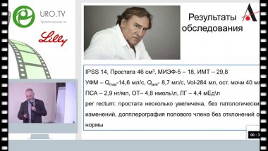 Спивак Л.Г.- Клинический случай пациента, страдающего СНМ на фоне гиперплазии простаты.