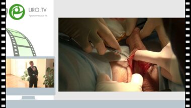 Кызласов П.С. - Одномоментная имплантация сфинктера и фаллопротеза