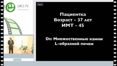 Гаджиев Н.К. - Множественные камни L-образной почки