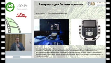 Ахвледиани Н.Д. - Аденомэктомия и радикальная простатэктомия: расстройства мочеиспускания и ЭД