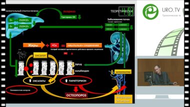 Бобровский Р.Н. - Диапевтический алгоритм уролитиаза с учётом индивидуального метаболизма пациента