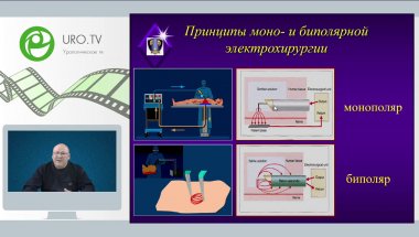 Мартов А.Г. - Эволюция эндоскопического лечения ДГПЖ: от ТУР к эндоскопической энуклеации